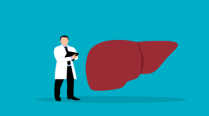 What is the liver transplant success rate? What can you not do after liver transplant surgery?