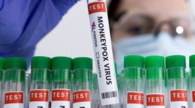 The virus can also spread from someone who is pregnant to the foetus, after birth through skin-to-skin contact, or from a parent with Monkeypox to an infant or child during close contact. (File)