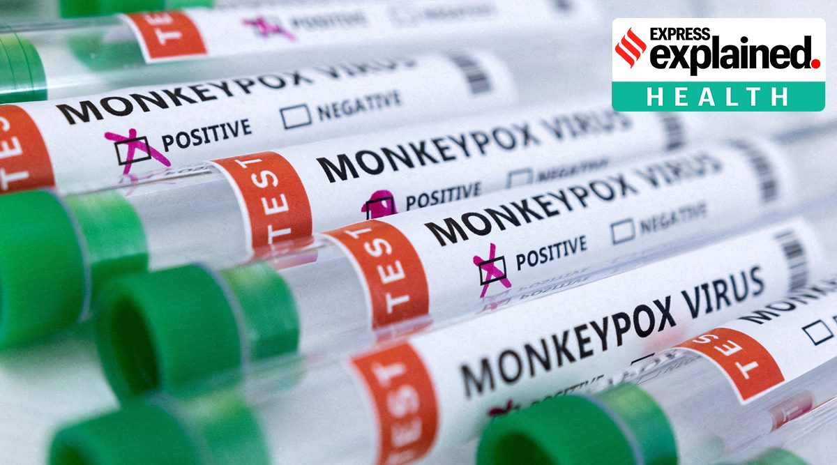 Test tubes labeled "Monkeypox virus positive and negative" are seen in this illustration. (Reuters: Dado Ruvic)
