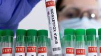 Youth who died in Thrissur succumbed to monkeypox: Kerala health dept