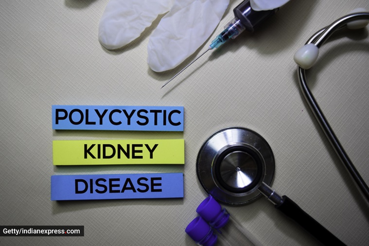 kidney, kidney health, unhealthy kidney, signs of unhealthy kidney, renal failure, polycystic kidney disease (PKD), what is polycystic kidney disease, indian express news