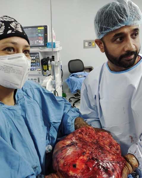 4 kg football-sized tumour removed from woman’s stomach in rare surgery