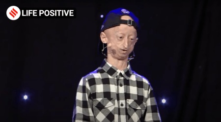 Michiel talks about how he lives life to the fullest, despite having Progeria.
(Source: TEDx Talks/Youtube)