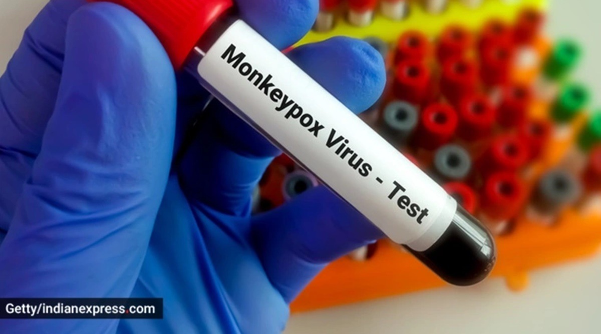 monkeypox