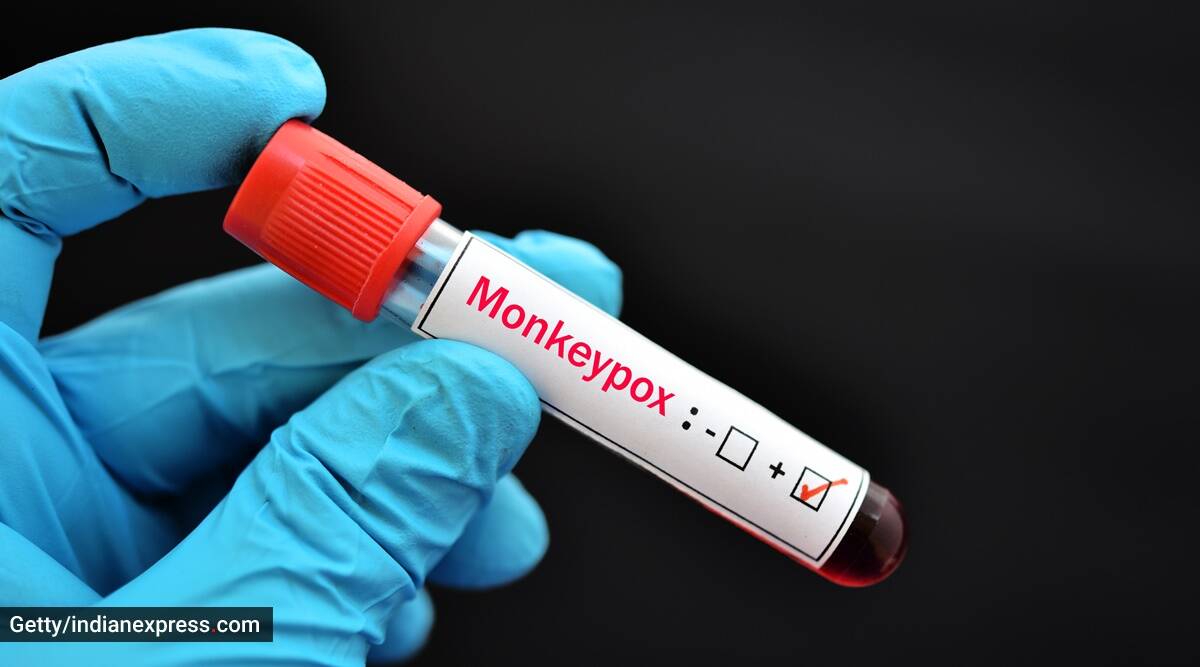 Photo of Une étude indique que la variole du singe peut causer des dommages neurologiques, y compris une encéphalite