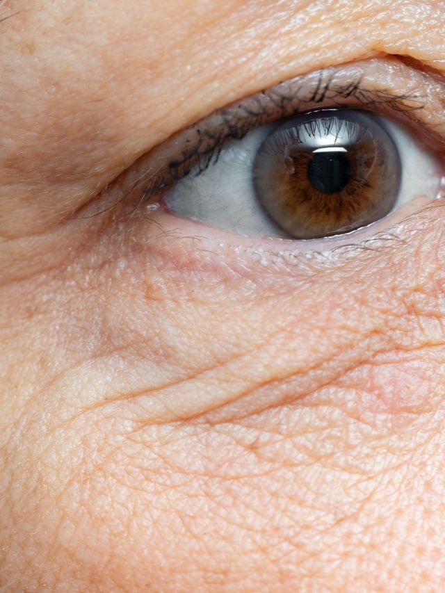 here-s-how-you-can-reduce-under-eye-wrinkles-the-indian-express