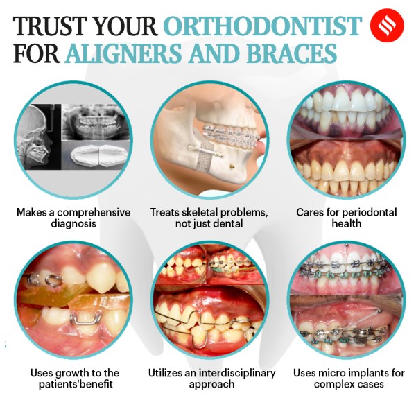 Braces vs Aligners: Which treatment is best for you? - Indiadens