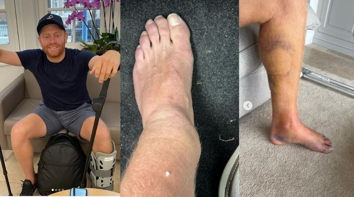 jonny-bairstow-shares-photos-of-injured-leg-that-shattered-his-t20-world-cup-dreams