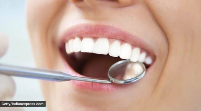There are two ways in which teeth-whitening procedures can be carried out: Professional bleaching of teeth at the dental clinic and at-home teeth whitening (Source:Gettyimages)
