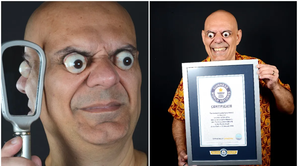 with-a-protrusion-of-18-2-mm-man-sets-guinness-world-record-title-for-the-farthest-eyeball-pop