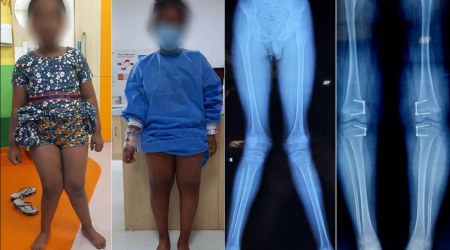 Common Orthopaedic Problems Seen In Children