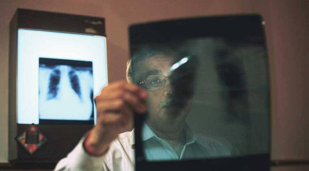 Good news for multidrug resistant TB patients as clinical trial finds