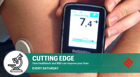 continuous glucose monitor