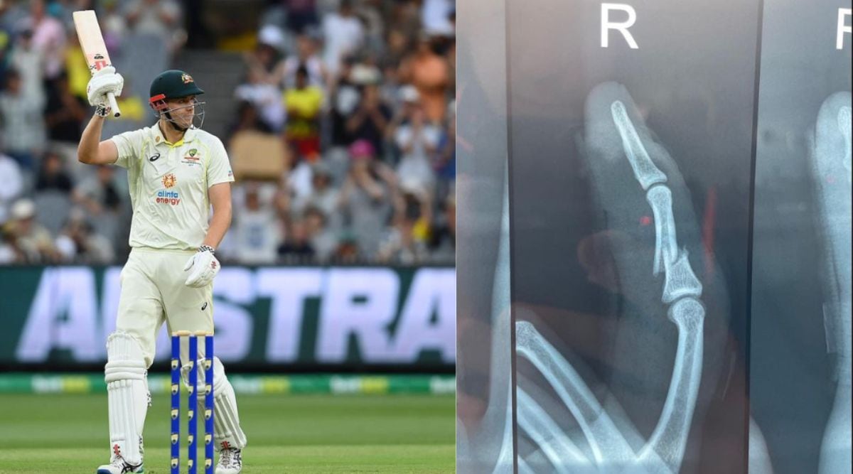 Cameron Green kept batting through pain Shares picture of broken