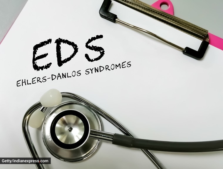 Jameela Jamil opens up about suffering from the ‘EhlersDanlos Syndrome