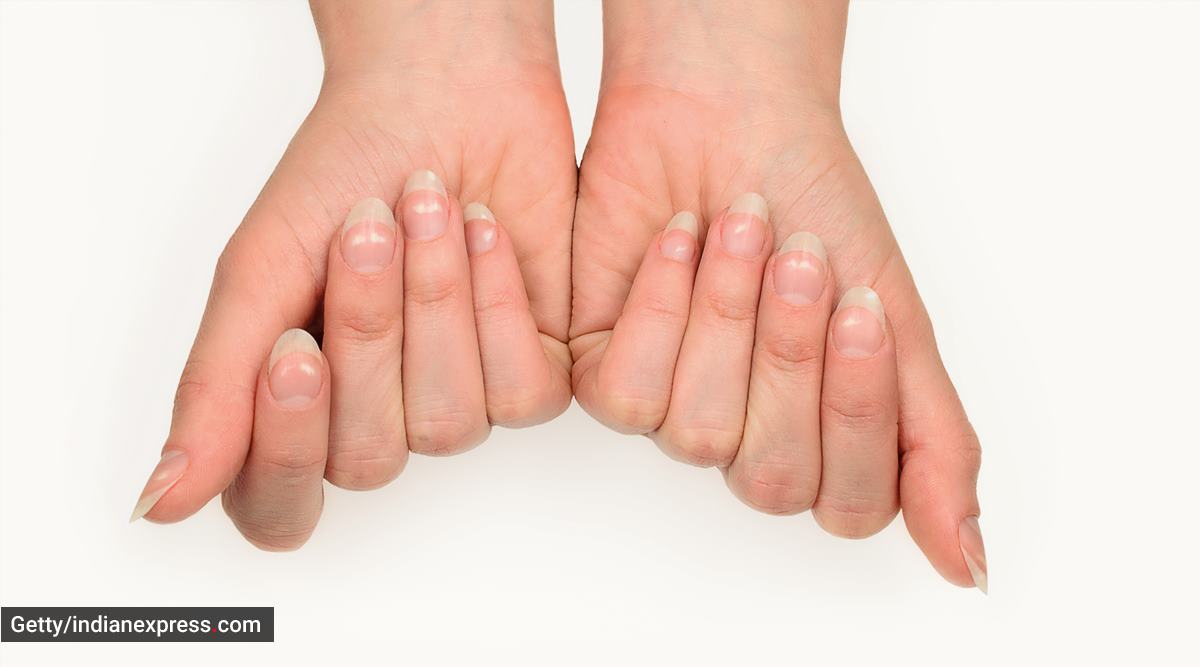 White Spots on Fingernails. Stock Image - Image of diseases, protein:  77744619