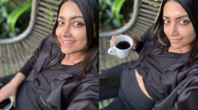 389px x 216px - Mamta Mohandas diagnosed with vitiligo; shares note on 'embracing the  journey' | Entertainment News,The Indian Express