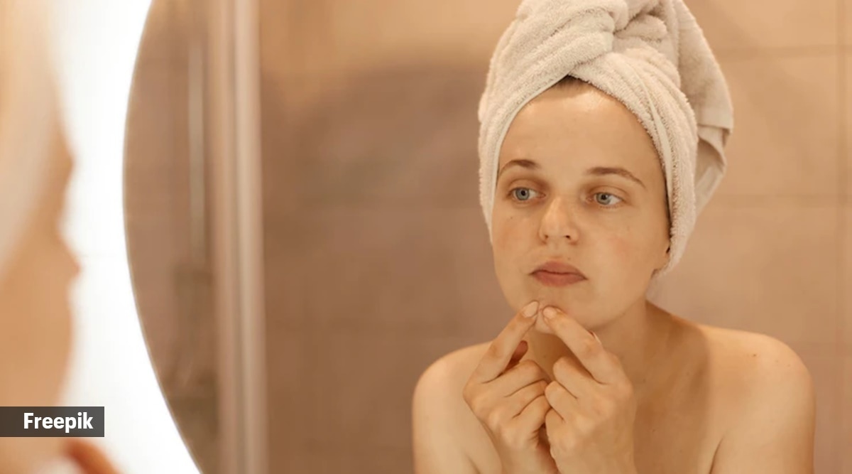 Blackheads Quick and easy expertapproved tips to combat the skin