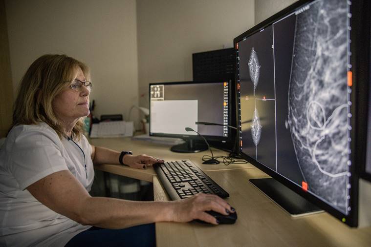 dr.  Éva Ambrózay, radióloga del hospital del condado de Bács-Kiskun en Kecskemét, Hungría, 20 de febrero de 2023. Hungría se ha convertido en un campo de pruebas clave para el software de IA para la detección del cáncer mientras los médicos debaten si la tecnología los reemplazará en las profesiones médicas.  (Akos Stiller/The New York Times)