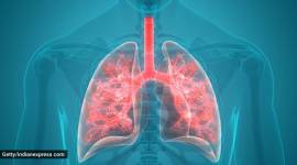 Mumbai bronchitis deaths, Mumbai bronchitis cases, bronchitis medicine, Mumbai bronchitis deaths, air pollution, respiratory diseases, respiratory diseases death, asthama, COPD, chronic respiratory diseases, Indian express