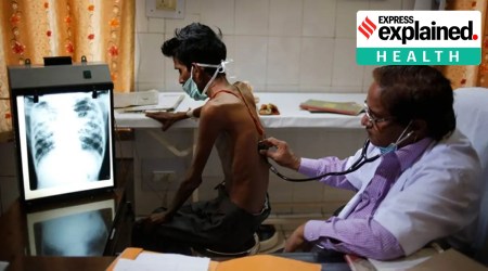 Photo of a man being examined by a doctor through a stethoscope.