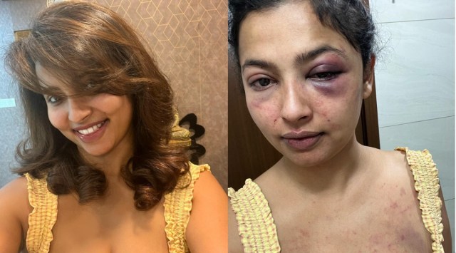 Actor Anicka Vikhraman has opened up her abusive relationship. (Photo: Anicka Vikhraman/Facebook)