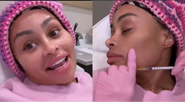 Blac Chyna Gets Face Fillers Dissolved A Week After Butt And Breast Reduction Surgery Know How