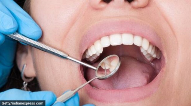 World Oral Health Day, oral health, World Oral Health Day 2023, Punjab news, Chandigarh, Indian Express, current affairs