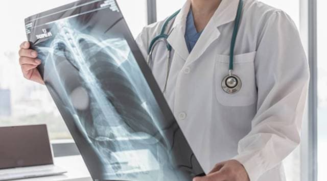 Adopt a TB patient scheme, Tuberculosis, tuberculosis cases, tuberculosis patient, Pune news, Maharashtra government, Indian Express, current affairs