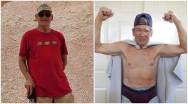 pulmonary disorder, open heart surgery, surgery, heart, guinness world record, california, india, indian express