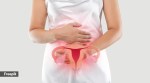 endometriosis