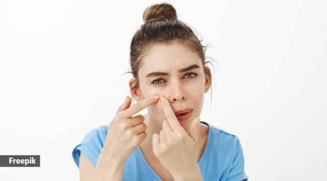 blind pimple