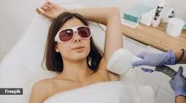 laser hair removal