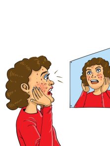 Tips and home remedies for combating skin acne, pimples