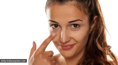 dark circles