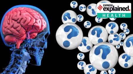 Breakthroughs in Alzheimer’s research: weighing benefit against costs