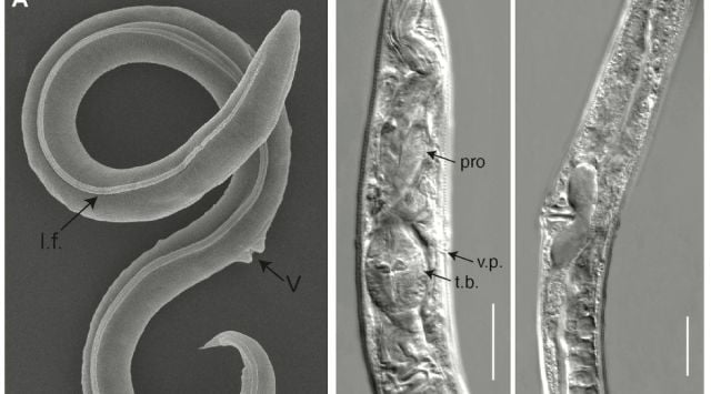 Siberian worms