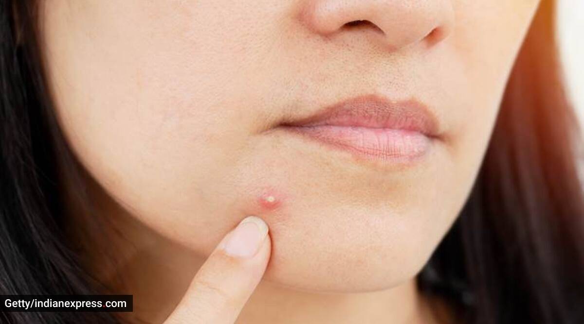 Monsoon Skincare: Why you need to follow these essential tips as your ...