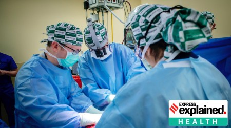 Pig Human Transplant