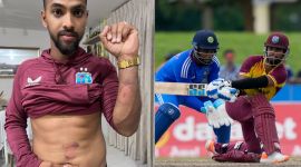 WI vs IND: Nicholas Pooran injuries