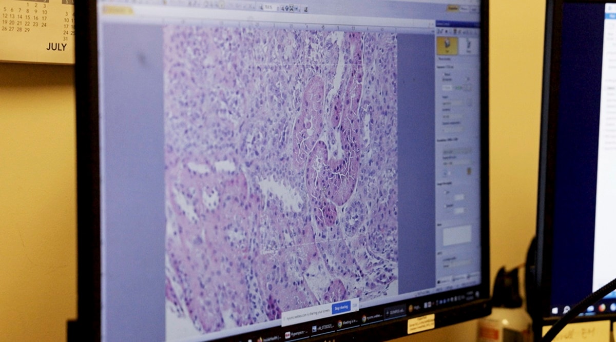 Pig kidney works in a donated body for over a month, a step toward