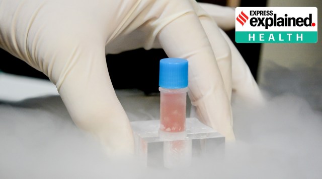 Stem Cell Therapy