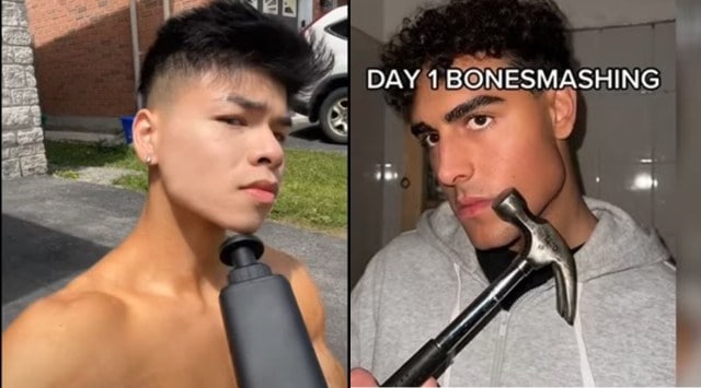 Know all about the bizarre trend of bone smashing 