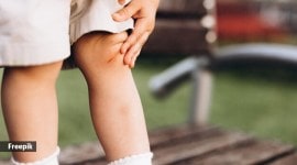 juvenile arthritis, world arthritis day, arthritis in children