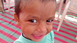 Kartik retinoblastoma