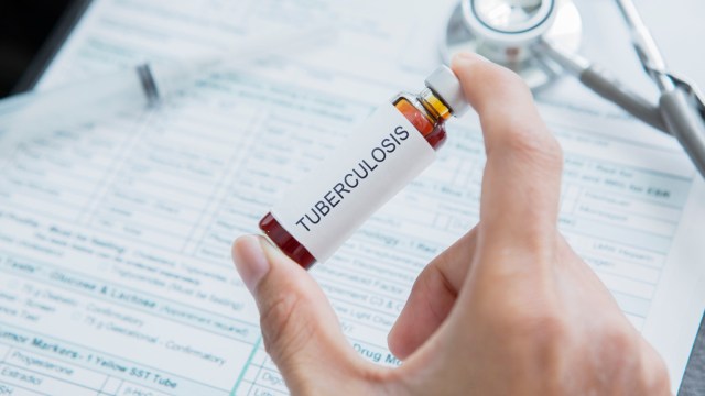 India accounted for the highest number of tuberculosis (TB) cases in the world in 2022
