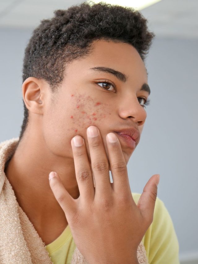 Common skin problems in men | The Indian Express