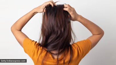 hair loss