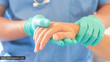 chronic kidney disease, kidney transplant, organ donations, cross-border organ swap, Kidney recipients, swap kidney transplant, exchanging of donors, indian express news