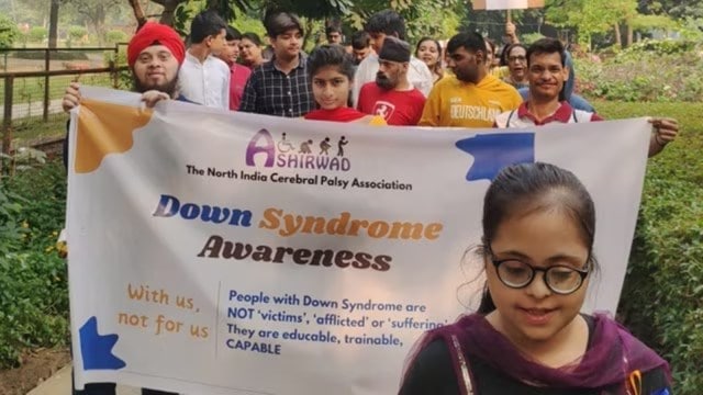 case study of down syndrome in india